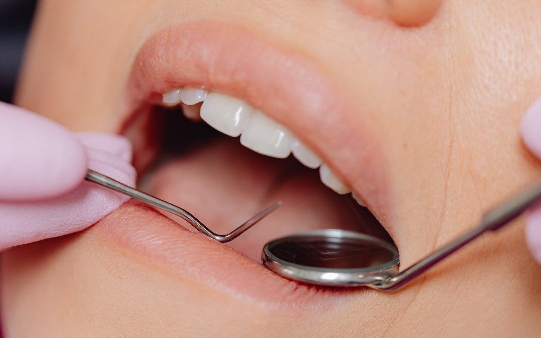 Quanto influisce la lingua sulla posizione dei denti? Più di quanto immagini!